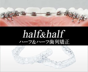 インビザライン、リンガル