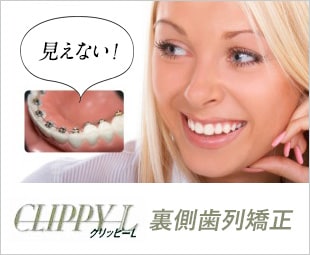 裏側歯列矯正